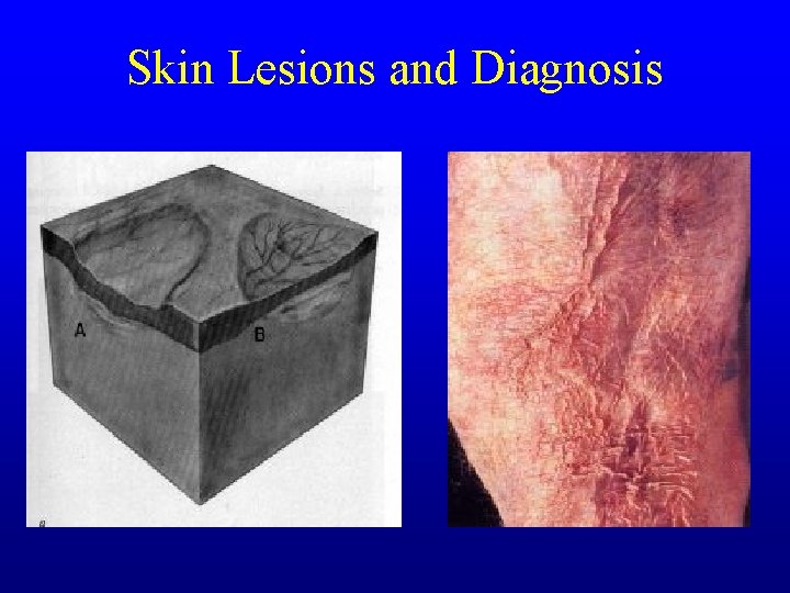 Skin Lesions and Diagnosis Skin Lesions and Diagnosis
