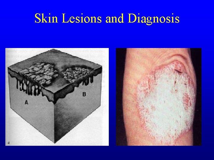 Skin Lesions and Diagnosis Skin Lesions and Diagnosis