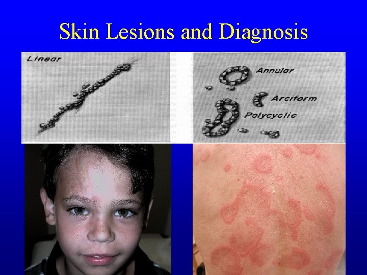 Skin Lesions and Diagnosis Skin Lesions and Diagnosis