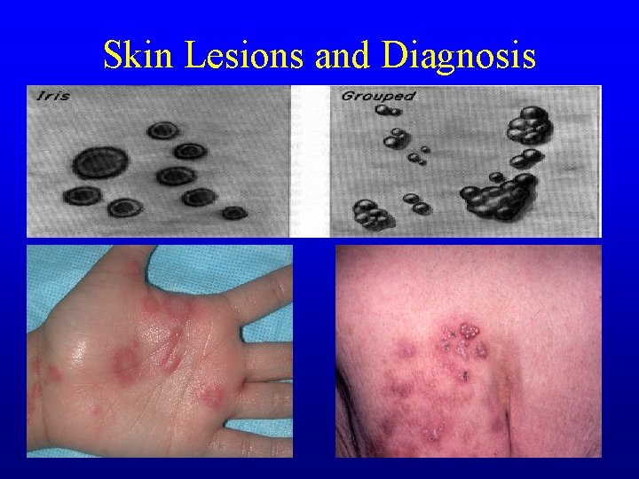 Skin Lesions and Diagnosis Skin Lesions and Diagnosis