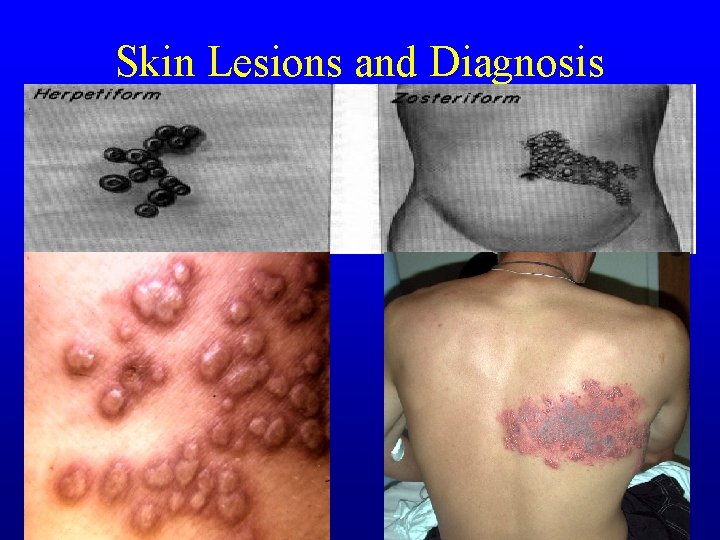 Skin Lesions and Diagnosis Skin Lesions and Diagnosis