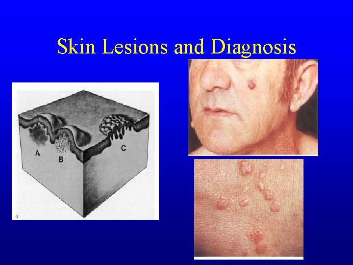 Skin Lesions and Diagnosis Skin Lesions and Diagnosis
