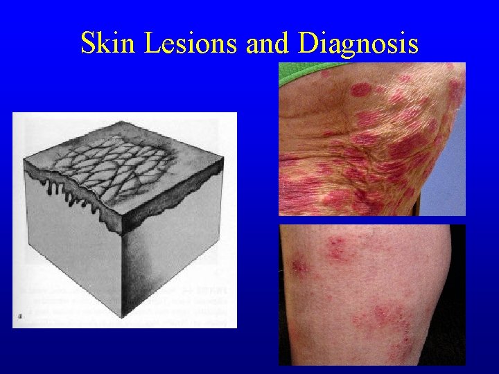 Skin Lesions and Diagnosis Skin Lesions and Diagnosis