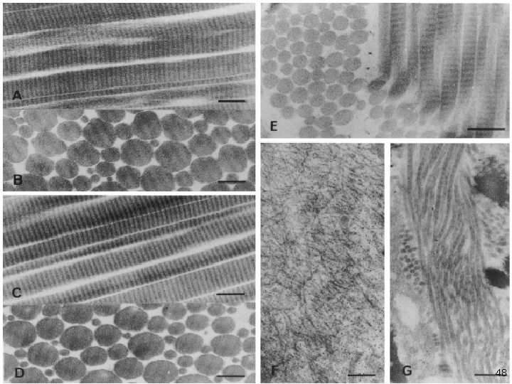 Collagène en microscopie électronique 48 