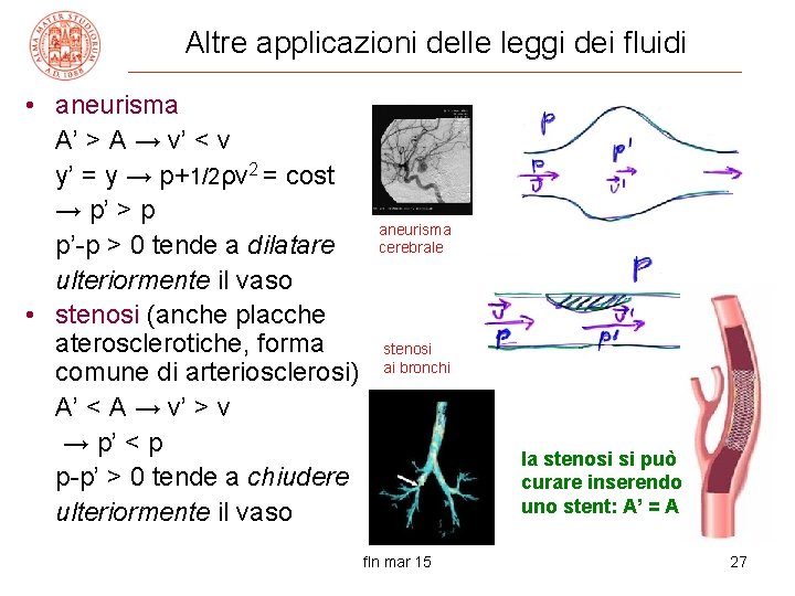 Altre applicazioni delle leggi dei fluidi • aneurisma A’ > A → v’ <
