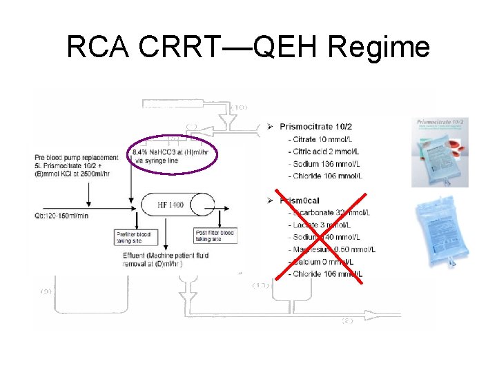 RCA CRRT—QEH Regime 