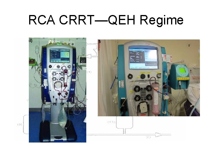 RCA CRRT—QEH Regime 