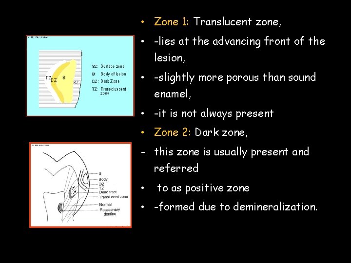  • Zone 1: Translucent zone, • -lies at the advancing front of the