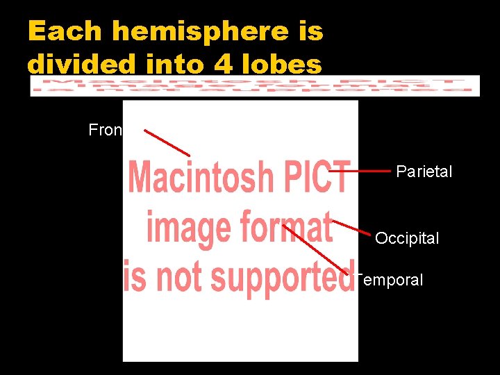 Each hemisphere is divided into 4 lobes Frontal Parietal Occipital Temporal 