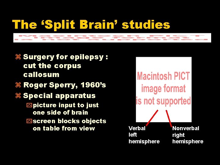 The ‘Split Brain’ studies Surgery for epilepsy : cut the corpus callosum Roger Sperry,