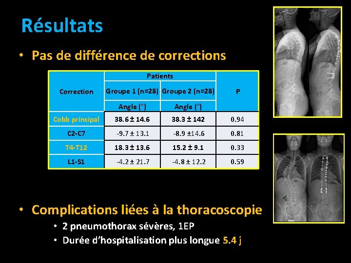 Résultats • Pas de différence de corrections Patients Correction Groupe 1 (n=28) Groupe 2 Résultats • Pas de différence de corrections Patients Correction Groupe 1 (n=28) Groupe 2