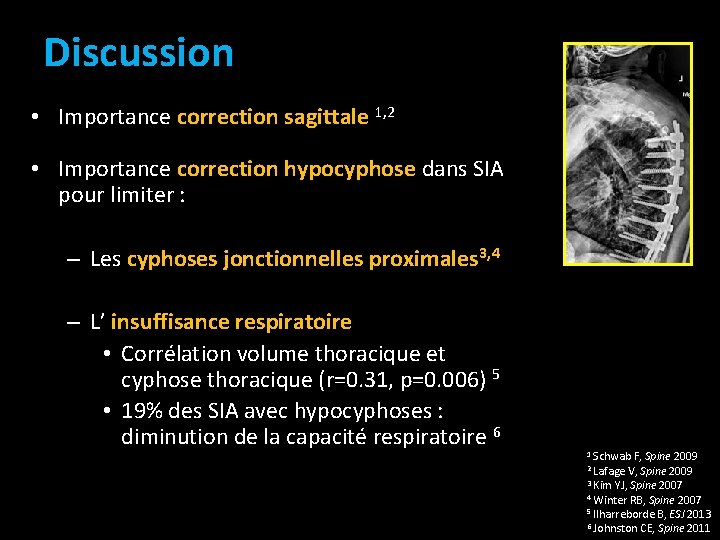 Discussion • Importance correction sagittale 1, 2 • Importance correction hypocyphose dans SIA pour Discussion • Importance correction sagittale 1, 2 • Importance correction hypocyphose dans SIA pour