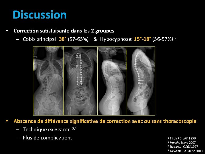 Discussion • Correction satisfaisante dans les 2 groupes – Cobb principal: 38˚ (57 -65%) Discussion • Correction satisfaisante dans les 2 groupes – Cobb principal: 38˚ (57 -65%)