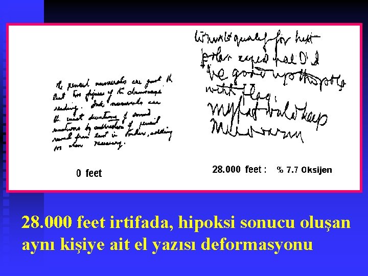 28. 000 feet irtifada, hipoksi sonucu oluşan aynı kişiye ait el yazısı deformasyonu 