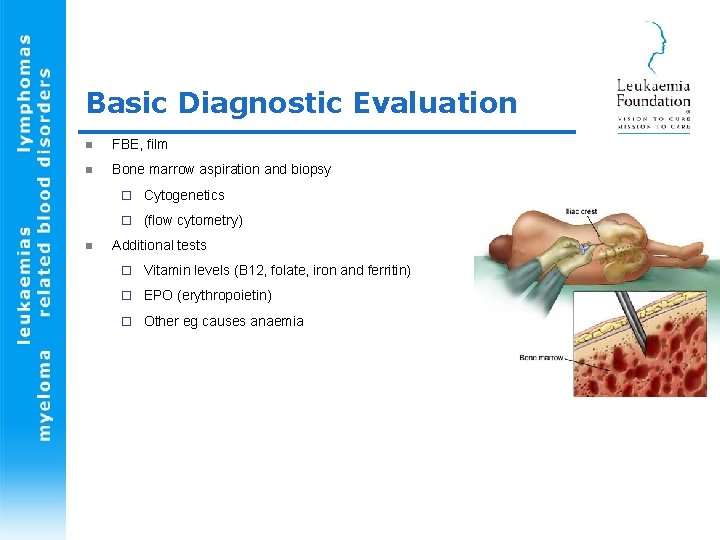 Basic Diagnostic Evaluation n FBE, film n Bone marrow aspiration and biopsy n ¨
