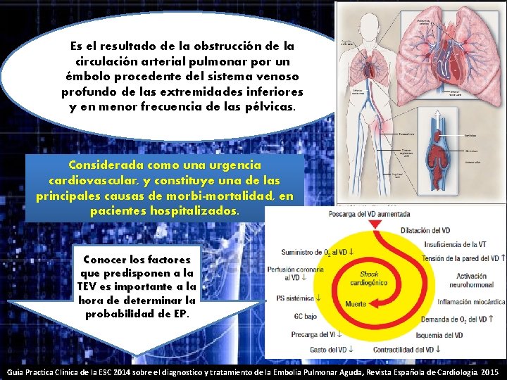 Es el resultado de la obstrucción de la circulación arterial pulmonar por un émbolo