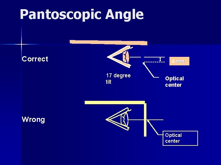 Pantoscopic Angle Correct 4 mm 17 degree tilt Optical center Wrong Optical center 