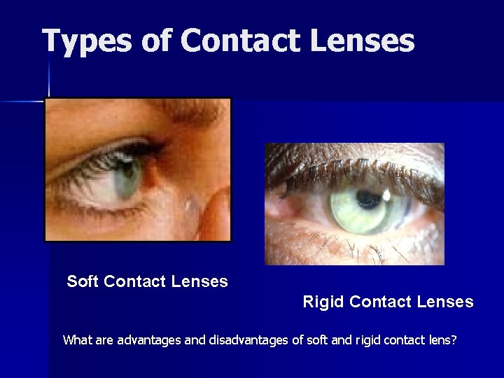 Types of Contact Lenses Soft Contact Lenses Rigid Contact Lenses What are advantages and