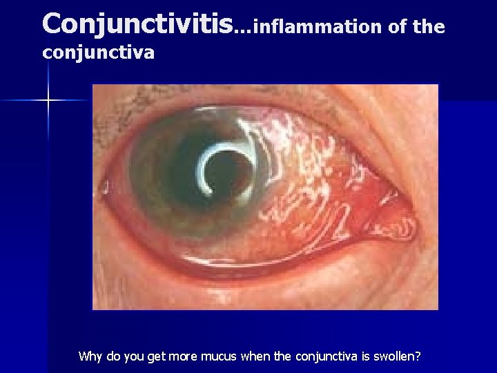 Conjunctivitis…inflammation of the conjunctiva Why do you get more mucus when the conjunctiva is