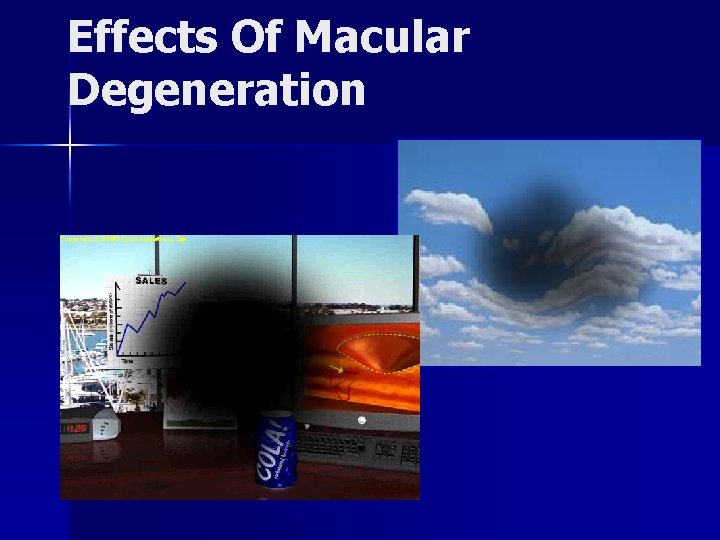 Effects Of Macular Degeneration 