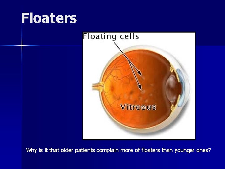 Floaters Why is it that older patients complain more of floaters than younger ones?