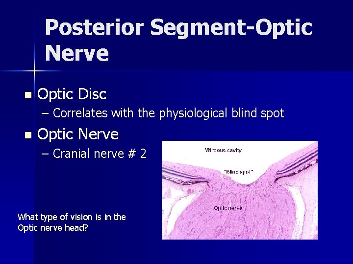 Posterior Segment-Optic Nerve n Optic Disc – Correlates with the physiological blind spot n