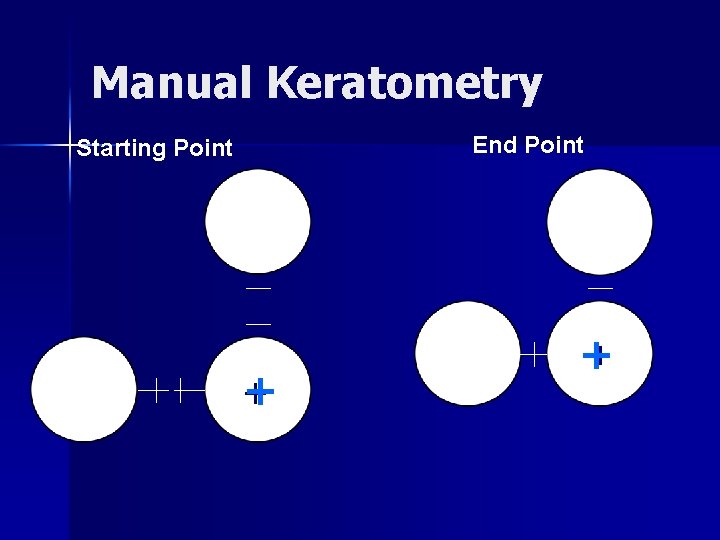 Manual Keratometry End Point Starting Point + + ++ 