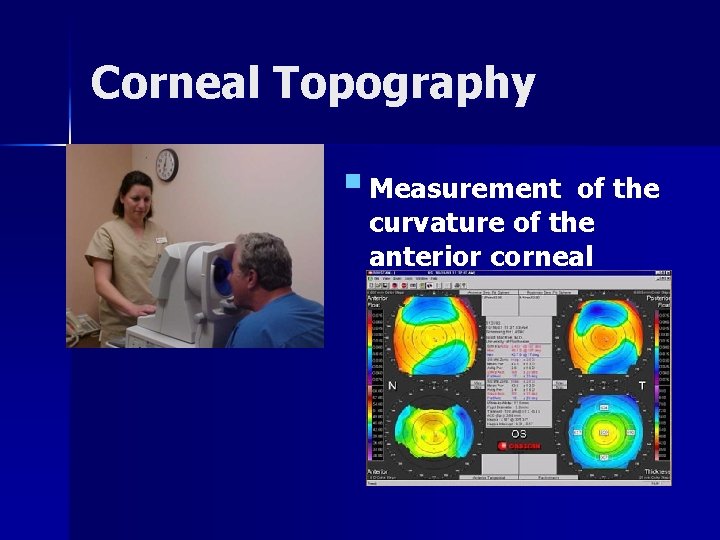 Corneal Topography § Measurement of the curvature of the anterior corneal surface. 