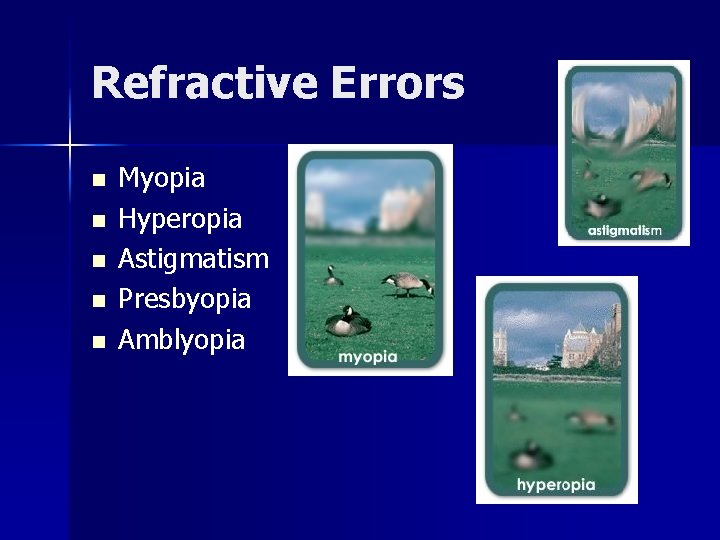 Refractive Errors n n n Myopia Hyperopia Astigmatism Presbyopia Amblyopia 