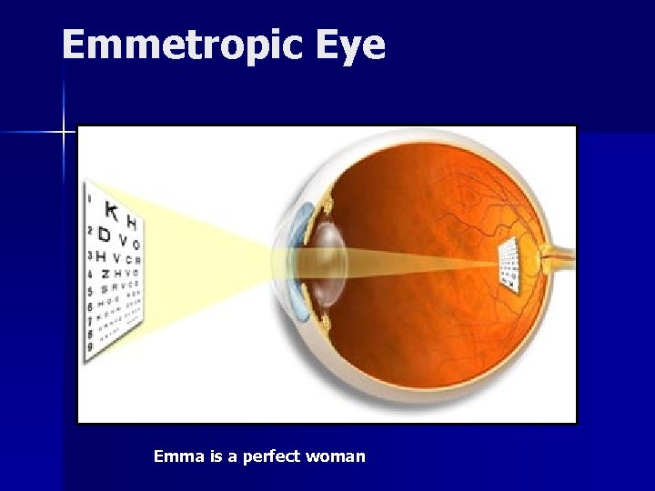 Emmetropic Eye Emma is a perfect woman 