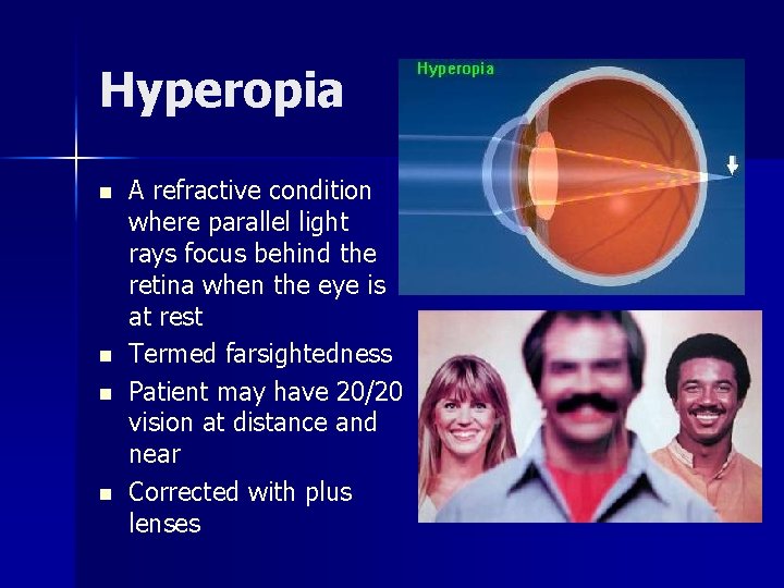 Hyperopia n n A refractive condition where parallel light rays focus behind the retina