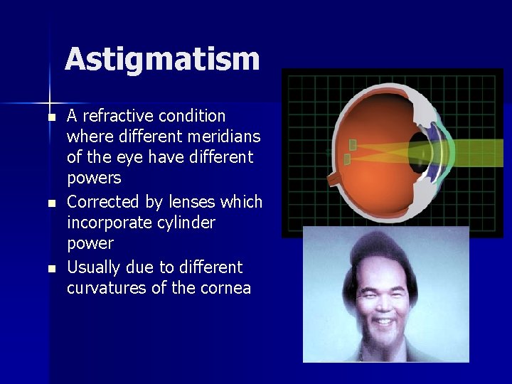 Astigmatism n n n A refractive condition where different meridians of the eye have