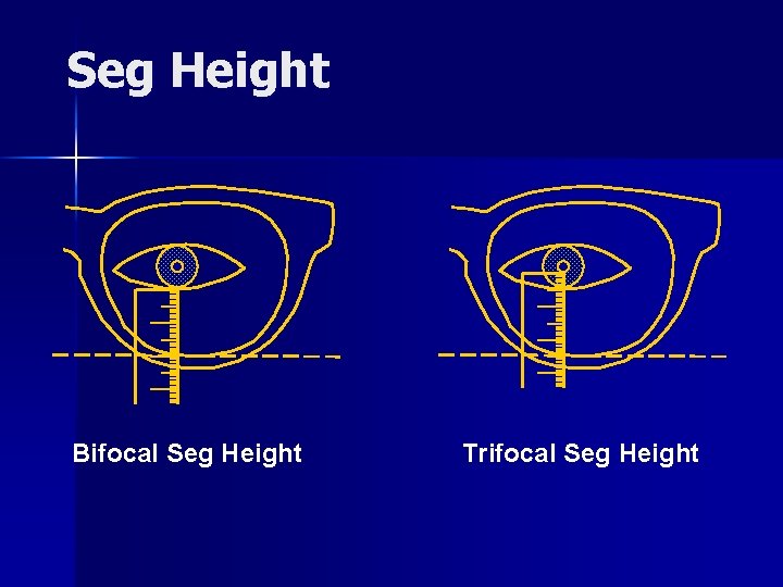 Seg Height Bifocal Seg Height Trifocal Seg Height 