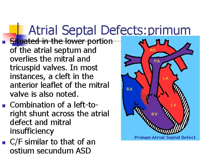 Atrial Septal Defects: primum n n n Situated in the lower portion of the