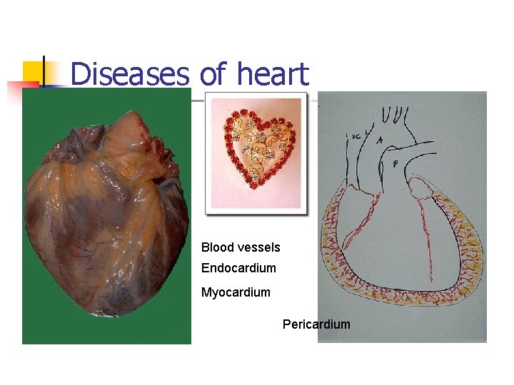 Diseases of heart Blood vessels Endocardium Myocardium Pericardium 