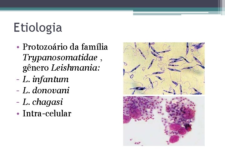 Etiologia • Protozoário da família Trypanosomatidae , gênero Leishmania: - L. infantum - L.