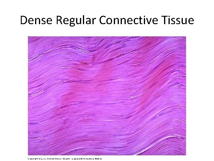 Dense Regular Connective Tissue 