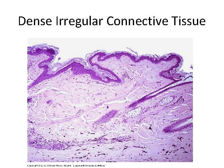 Dense Irregular Connective Tissue 