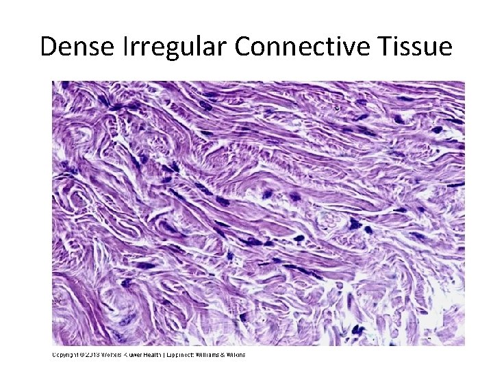 Dense Irregular Connective Tissue 