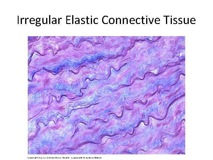 Irregular Elastic Connective Tissue 