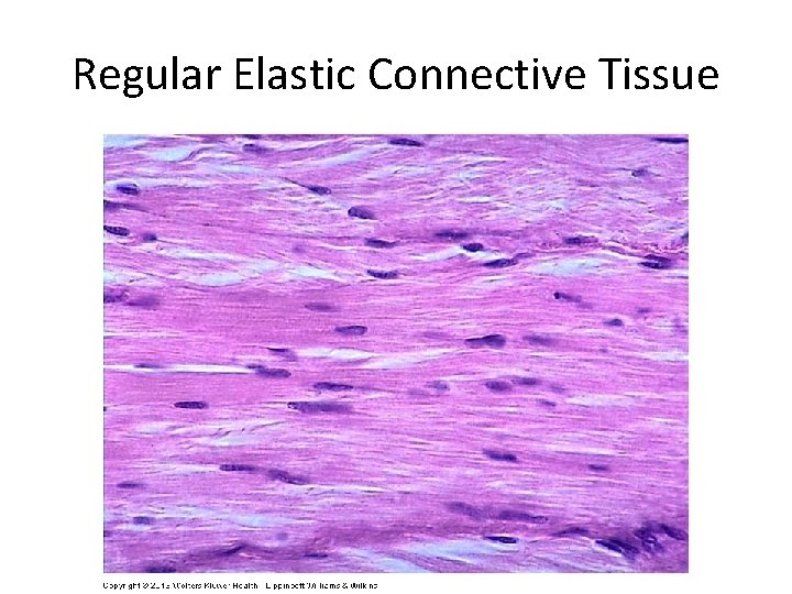 Regular Elastic Connective Tissue 
