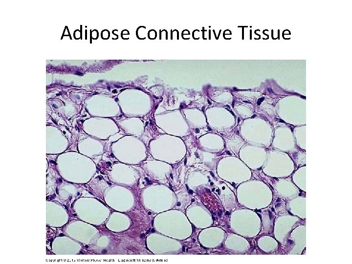 Adipose Connective Tissue 