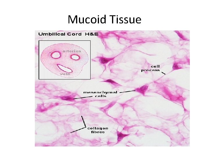 Mucoid Tissue 