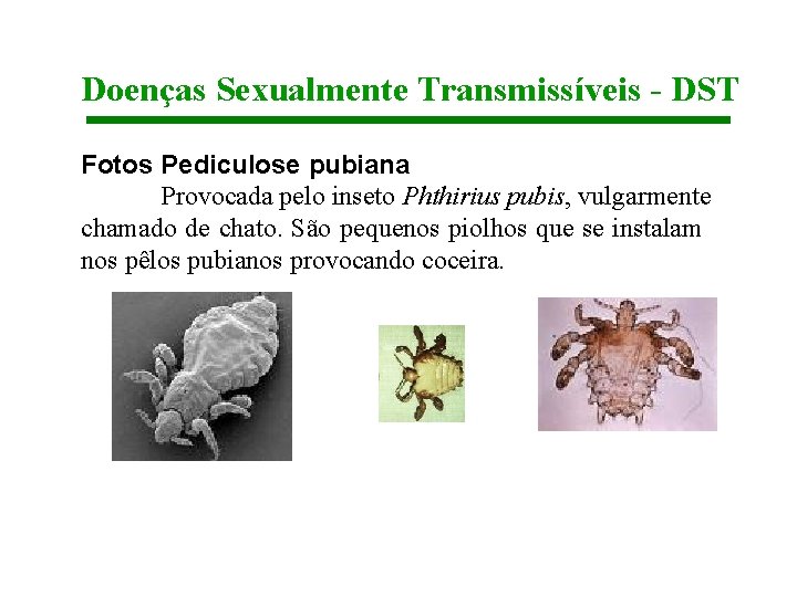Doenças Sexualmente Transmissíveis - DST Fotos Pediculose pubiana Provocada pelo inseto Phthirius pubis, vulgarmente