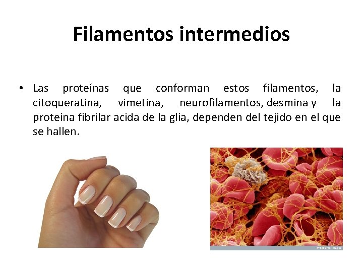 Filamentos intermedios • Las proteínas que conforman estos filamentos, la citoqueratina, vimetina, neurofilamentos, desmina