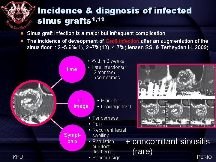 Incidence & diagnosis of infected sinus grafts 1, 12 Sinus graft infection is a