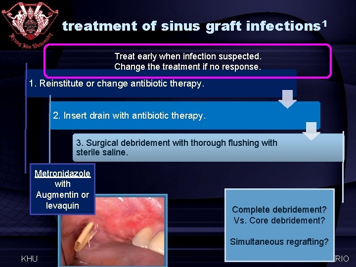 treatment of sinus graft infections 1 Treat early when infection suspected. Change the treatment