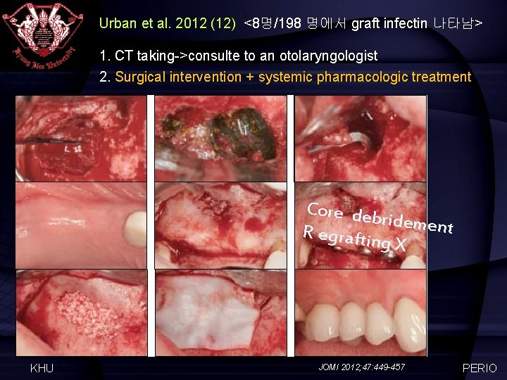 Urban et al. 2012 (12) <8명/198 명에서 graft infectin 나타남> 1. CT taking->consulte to