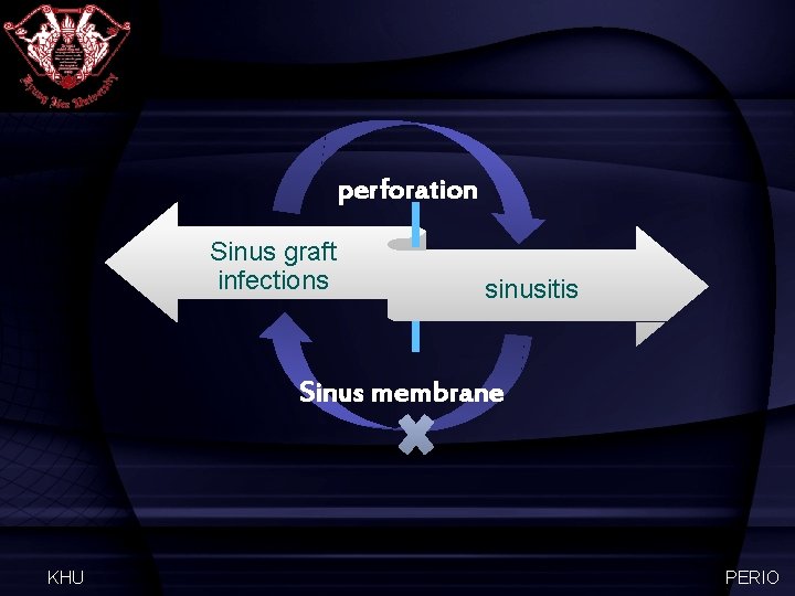 perforation Sinus graft infections sinusitis Sinus membrane KHU PERIO 