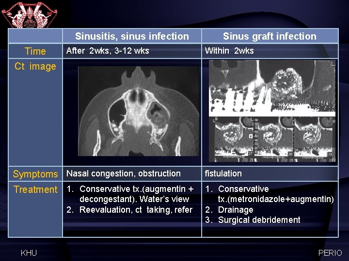 Sinusitis, sinus infection Time After 2 wks, 3 -12 wks Sinus graft infection Within